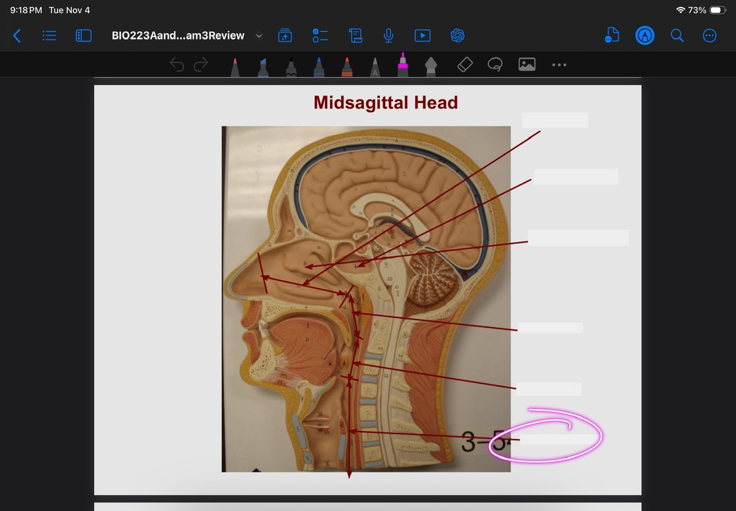 <p>What is this?</p>