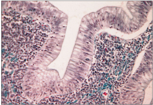 <p>Identify the structure:</p><p>Specie:</p><p>Stain used:</p>