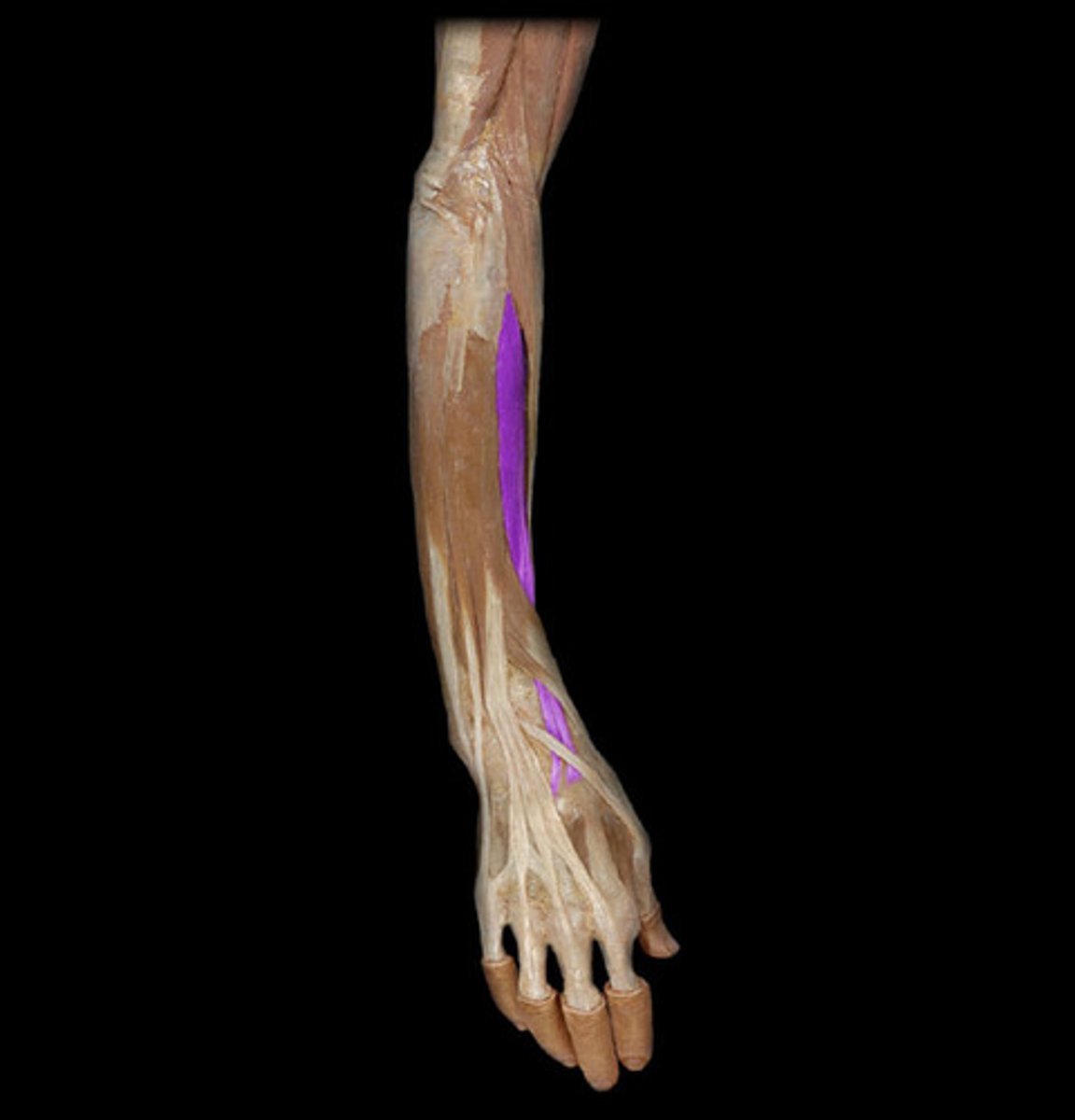 <p>Origin: Lateral epicondyle</p><p>Insertion: Base of 2nd and 3rd metacarpals</p><p>Action: Extend wrist, abduct, and radially deviate wrist.</p><p>Innervation: Radial nerve</p>
