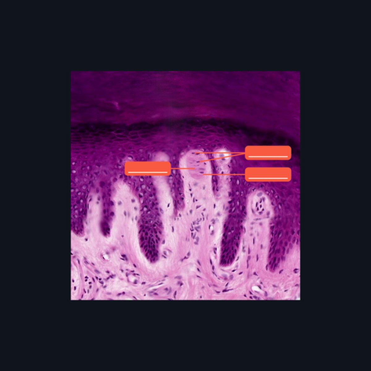 <p>Identify each pointed structures.</p>