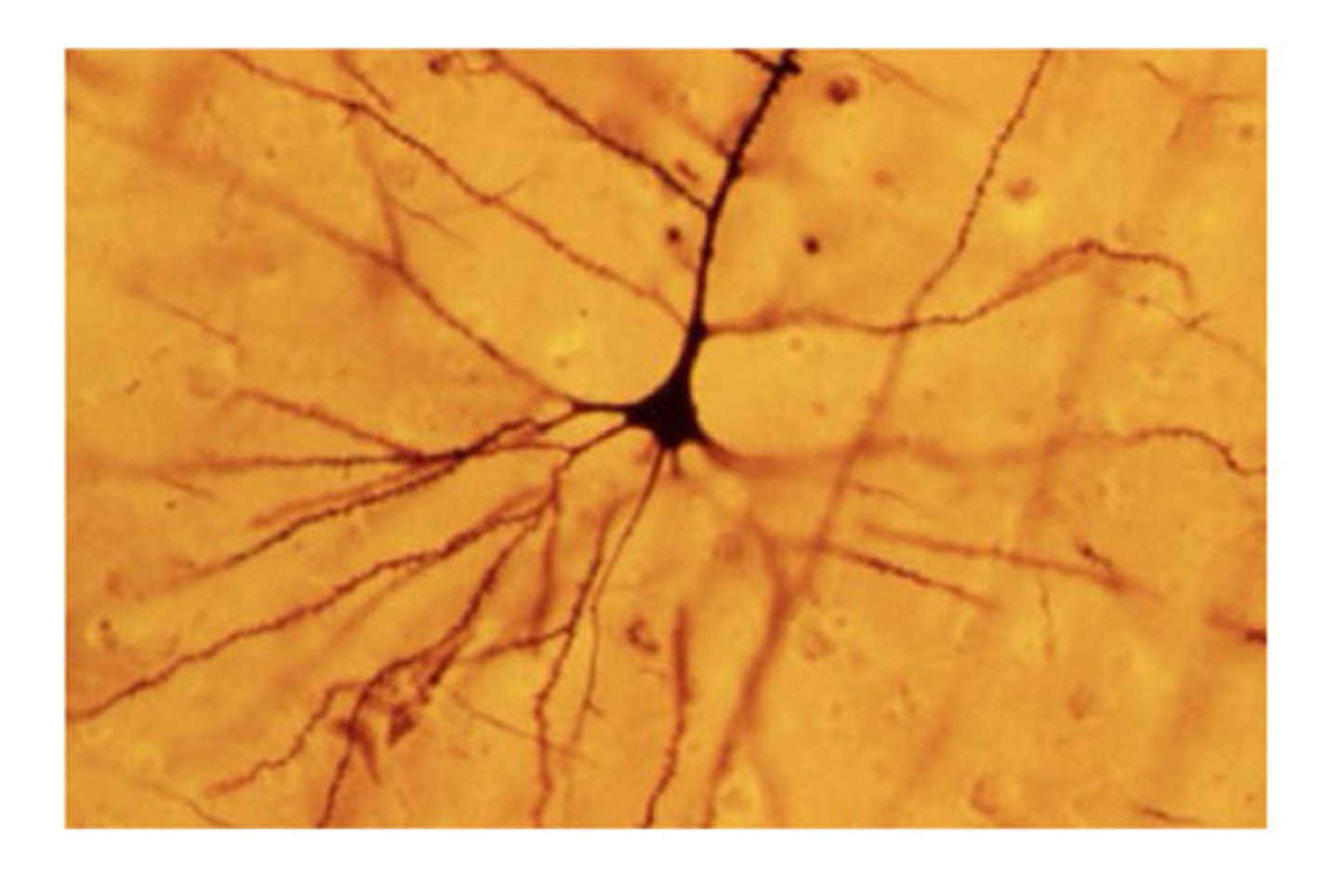<p>-stains only a few neurons (gold in color)</p><p>-stains the entire cell as well as dendrites</p>