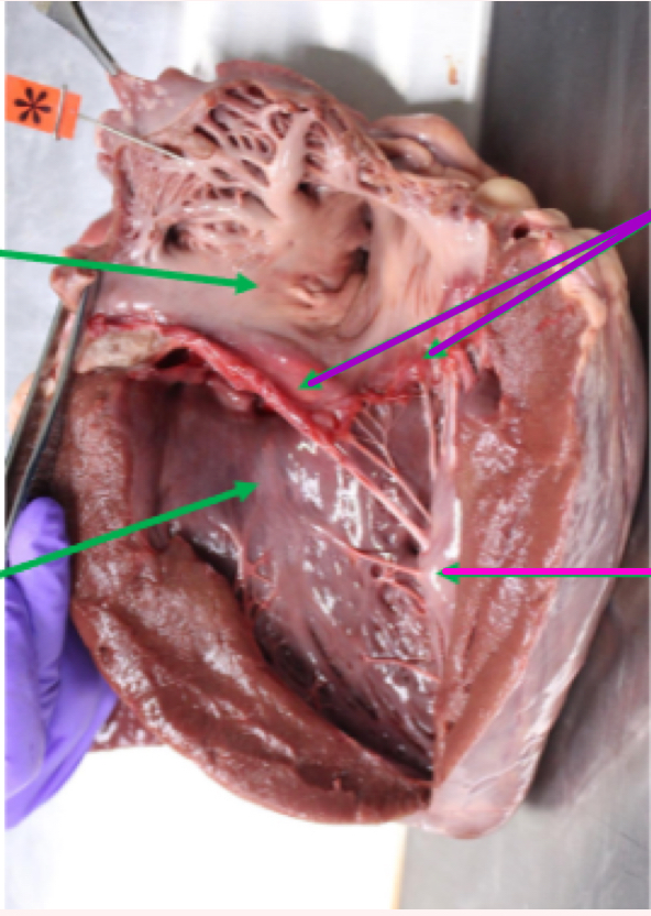 <p>What is the tagged structure?</p>