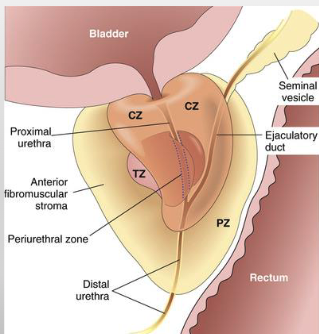 <p>• PZ = PERIPHERAL ZONE</p><p>• TZ = TRANSITIONAL ZONE</p><p>• CZ = CENTRAL ZONE</p><p>• PUZ = PERIURETHRAL ZONE</p>