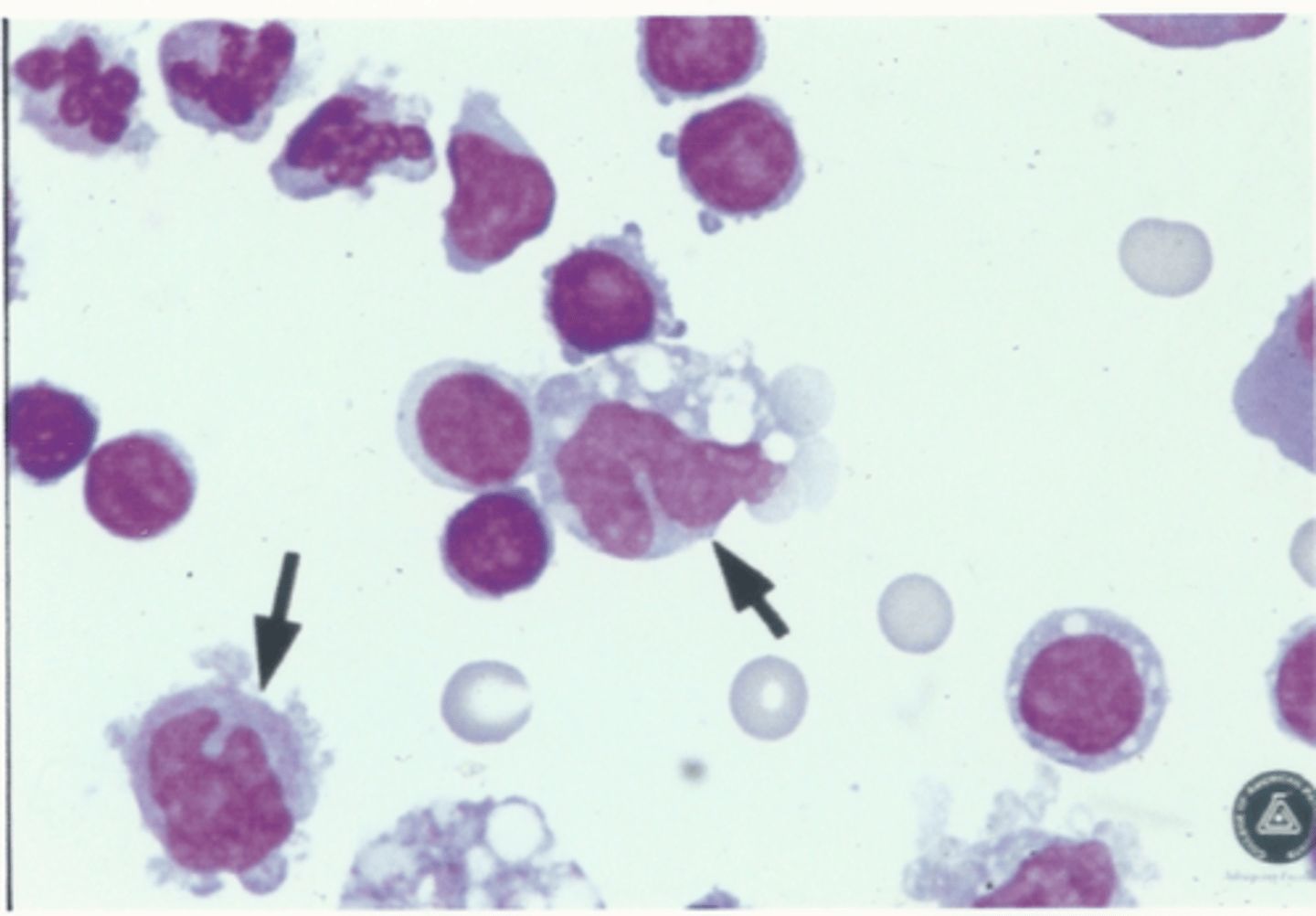 <p>Identify the cells in this body fluid</p>