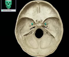 <p>Name this foramen.</p>