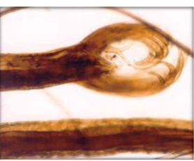 <p>What GIN is shown in this image </p><p>why </p><p>found where </p><p>symptoms of infection </p><p>ppp? </p>