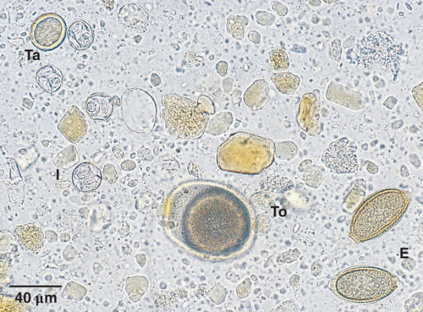 <p>Which parasite is Ta if it is from a cat</p>