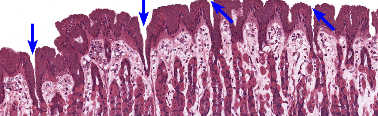 <p>histology, holds many gastric glands</p>