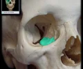 <p>forms part of the inferior surface of the orbit, located inferior and lateral to the lacrimal bones</p>