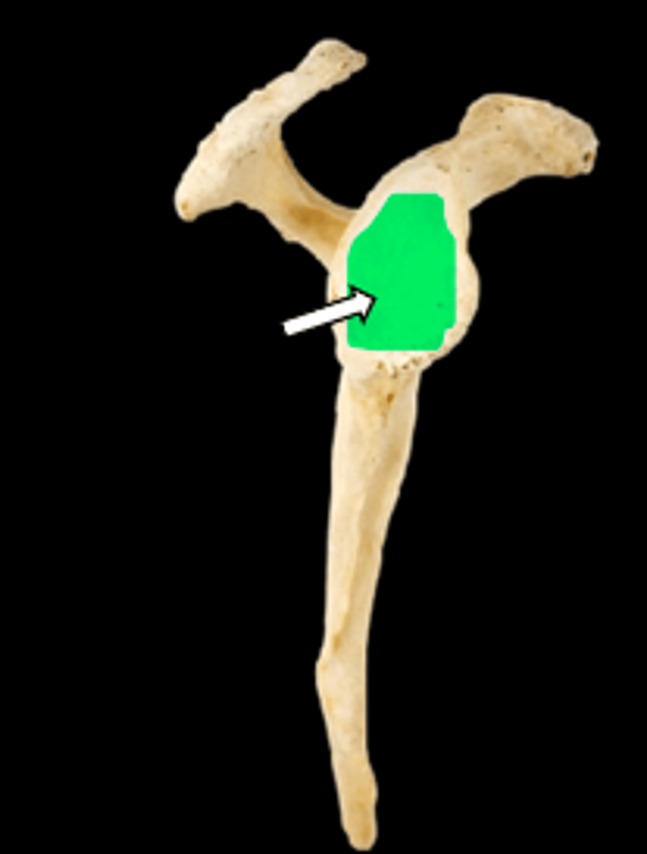 <p>name the part</p>