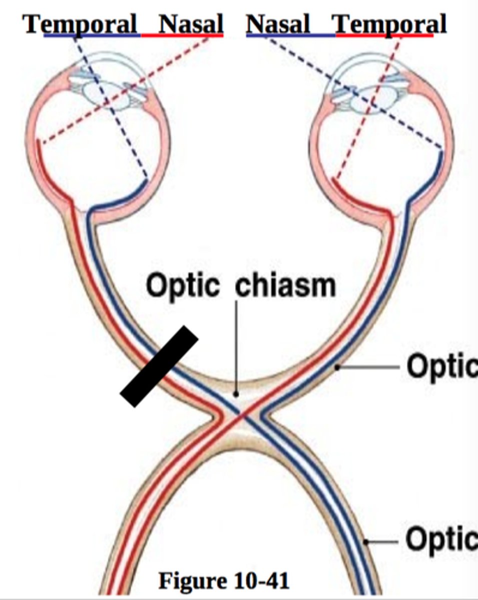 <p>Common causes include glaucoma, optic neuritis, elevated intracranial pressure</p>