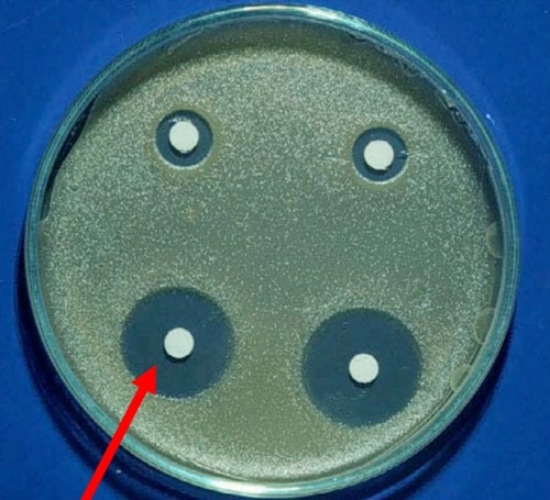 (antibiotic resistance) a large zone of inhibition, no bacterial growth surrounds the antibiotic disk