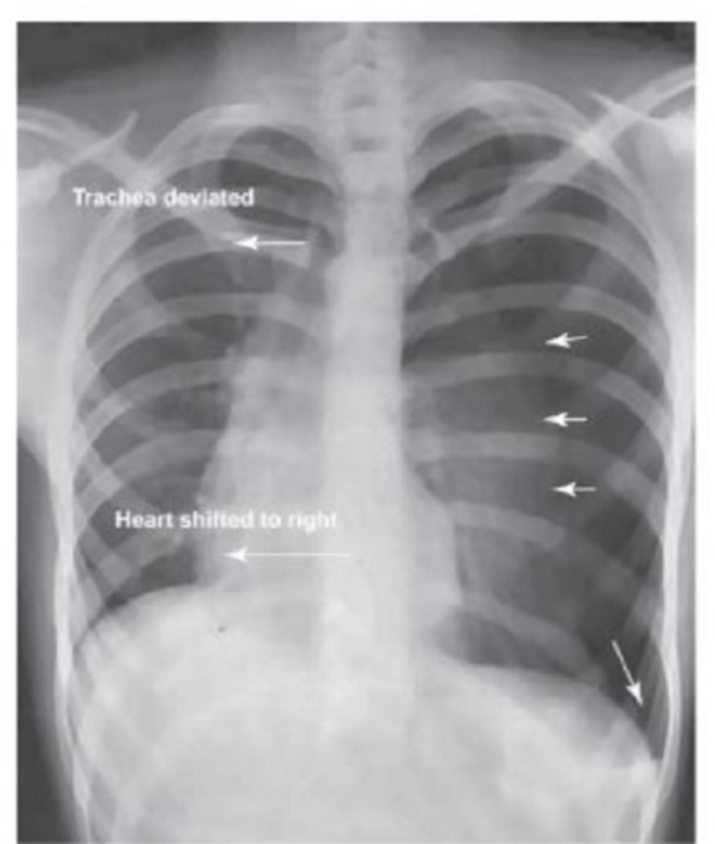 <p>Name the pathology</p>