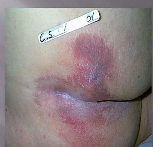 <p>What injury is this?</p>