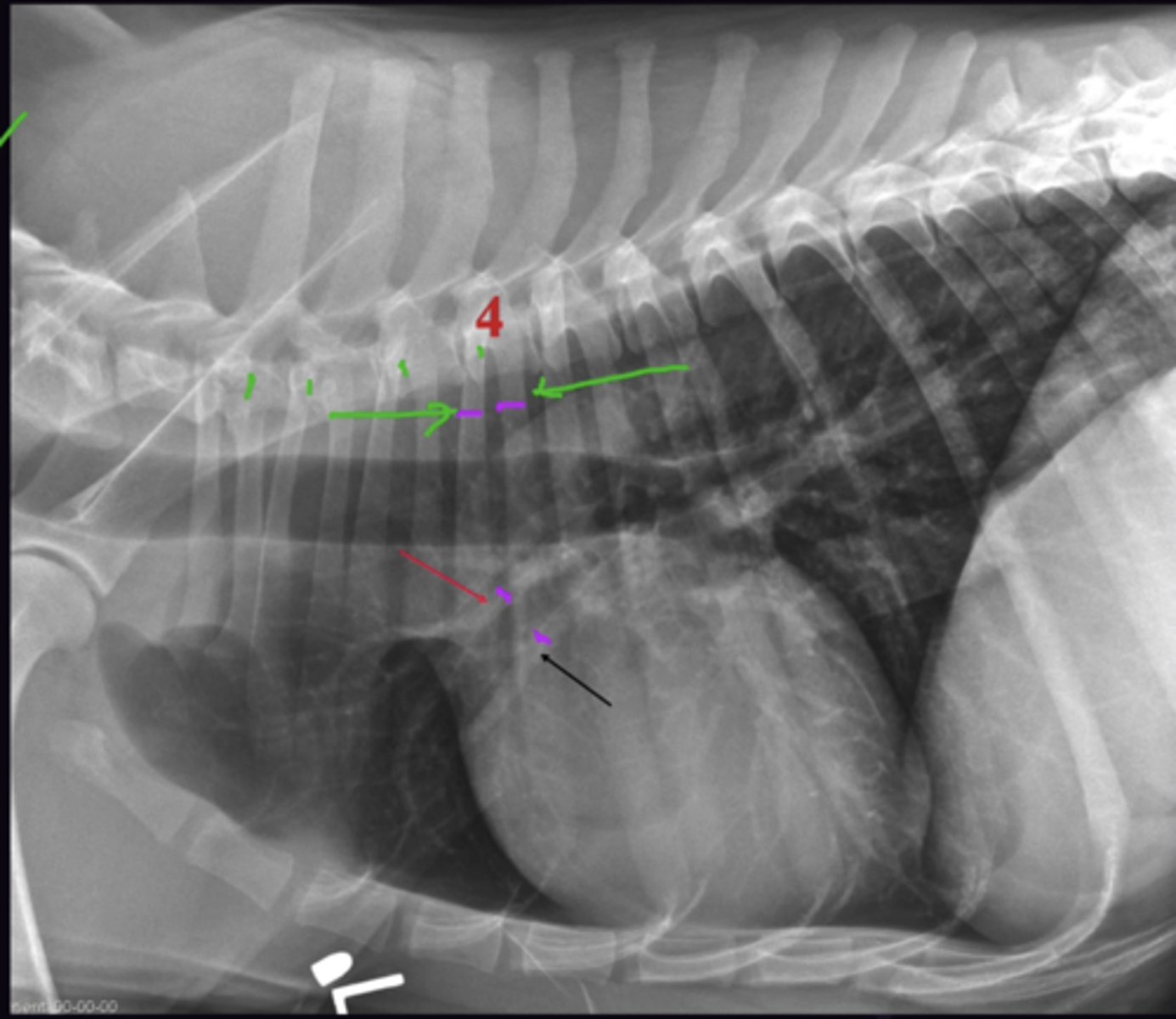 <p>1. Cranial lobar vessels</p><p>2. Are they the same width</p><p>3. Taken on the 4th Rib. Look at the width of the PA + PV where they cross the 4th ribs. Compare this to the width of the 4th rib near the spine (Normal PA + PV is approx. 3/4 the width of the rib)</p><p>4. Check both the left and right lateral as one will be better than the other (Usually left lateral)</p>