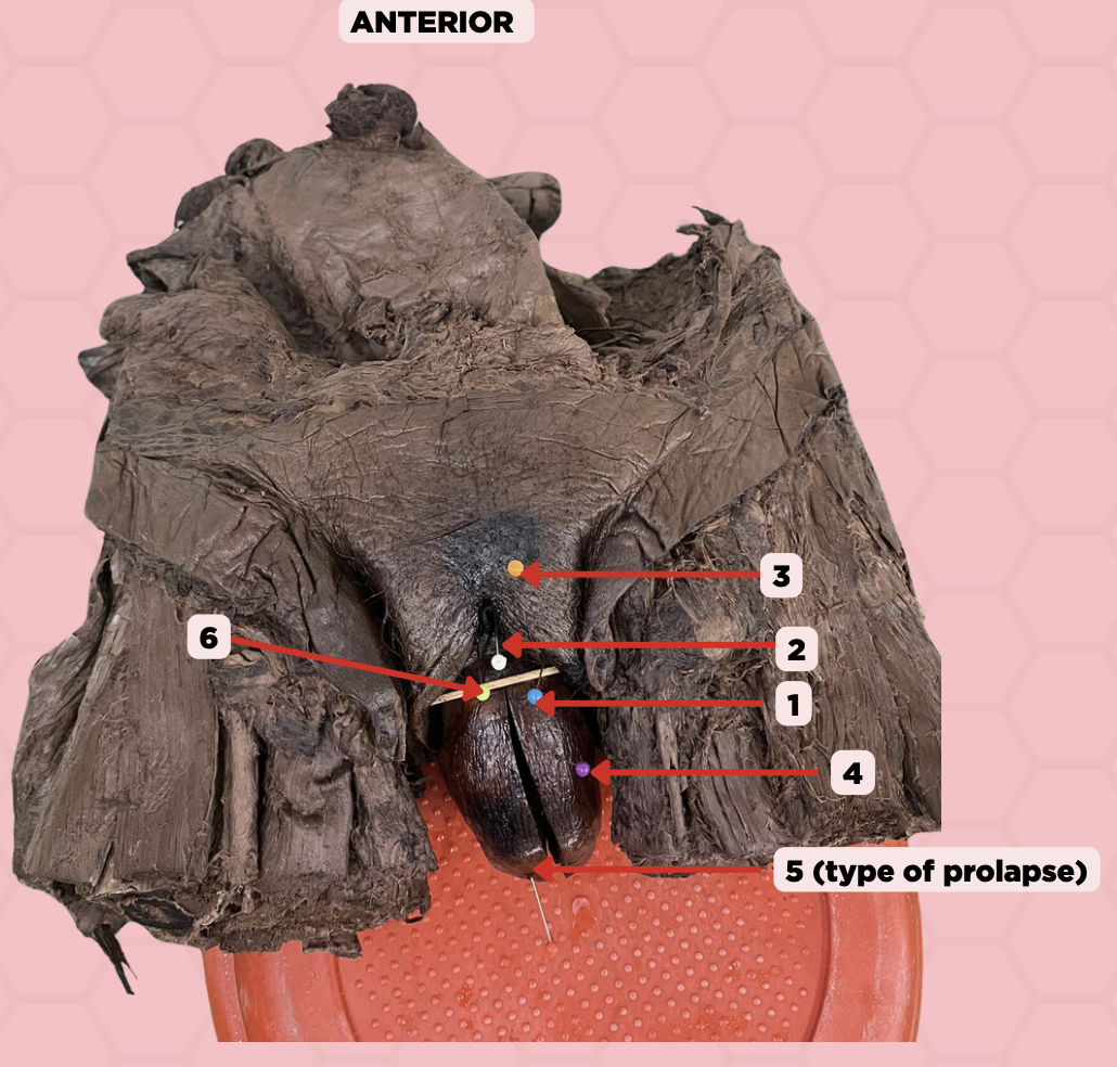 <p>Identify the structure labeled as 3.</p>