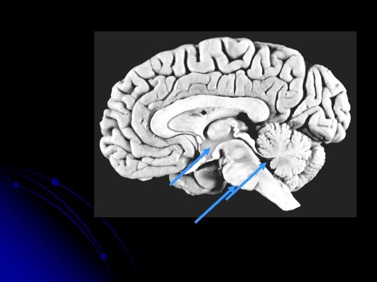 <p>what is the first arrow pointing to</p>