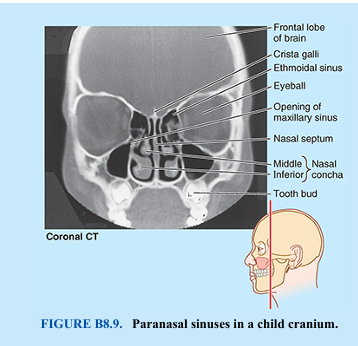 <p>The mandible is the most dynamic of our bones; its size and shape and the number of teeth it normally bears undergo considerable change with age. In the neonate, the mandible consists of two halves united in the median plane by a cartilaginous joint, the mandibular symphysis. Union between the halves of the mandible is affected by means of fibrocartilage. This union begins during the 1st year, and the halves are fused by the end of the 2nd year. The body of the mandible in neonates is a mere shell lacking an alveolar part with each half enclosing five deciduous teeth. These teeth usually begin to erupt in infants at approximately 6 months of age. The body of the mandible elongates, particularly posterior to the mental foramen (Fig. B8.2), to accommodate this development. Later, eight permanent teeth begin to erupt during the 6th year of life (Fig. B8.8). Eruption of the permanent teeth is not complete until early adulthood.</p><p>Rapid growth of the face during infancy and early childhood coincides with the eruption of deciduous teeth. Vertical growth of the upper face results mainly from dento-alveolar development of alveolar bone. These changes are more marked after the permanent teeth erupt. Concurrent enlargement of the frontal and facial regions is associated with the increase in the size of the paranasal sinuses, the air-filled extensions of the nasal cavities in certain cranial bones (Fig. B8.9). Most paranasal sinuses are rudimentary or absent at birth. Growth of the paranasal sinuses is important in altering the shape of the face and in adding resonance to the voice</p>