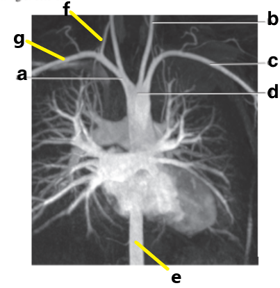 <p>What is letter e ?</p>
