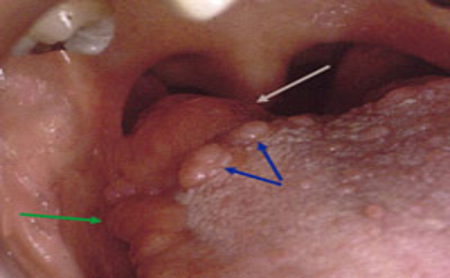 <p><span>near airway and food passages</span></p>