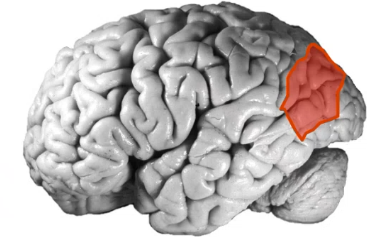 <p>damage to ______ _____ cortex can cause the inability to recognize objects (visual agnosia) and stimulation can cause complex visual hallucinations like objects changing size or distorting shape (alice in wonderland syndrome) which can happen if they get mono in young children </p>