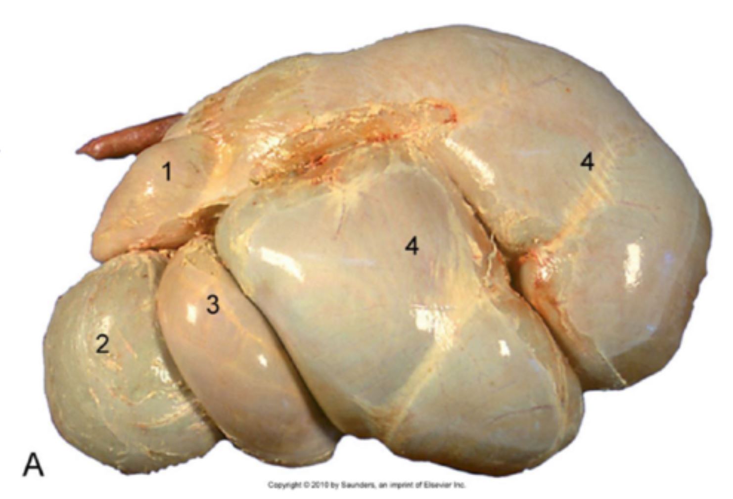<p><span>What stomach compartment is labeled #3 in this left side view of the ruminant stomach?</span></p>