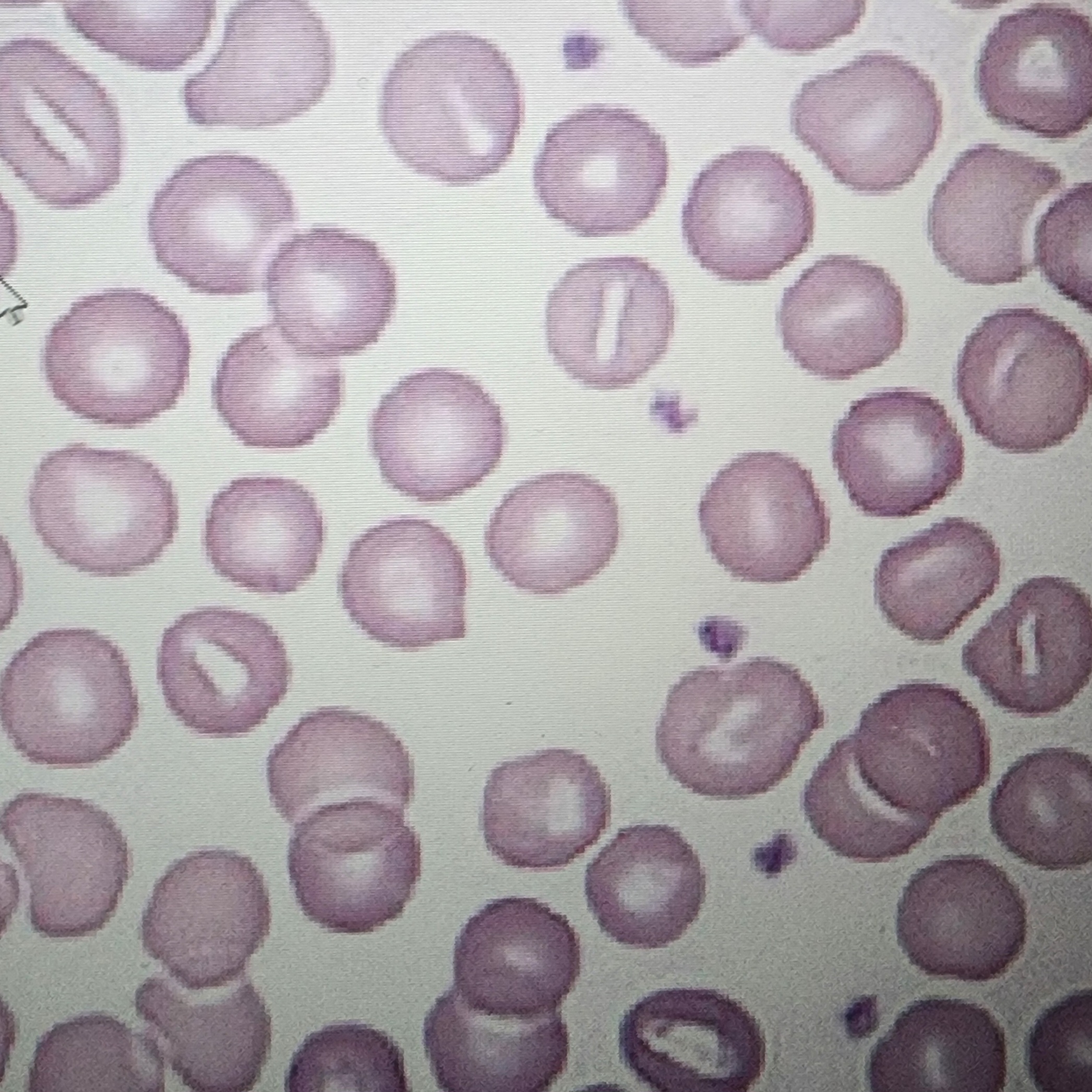 <p>Slit-like pale region in the center</p>