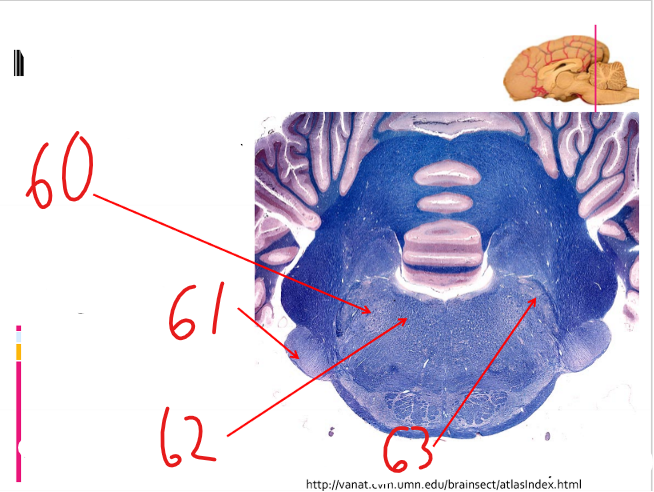 What is this a cross section through?