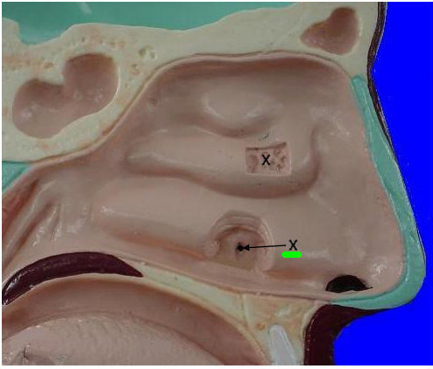 <p>hole in the orange </p><ul><li><p>3D space</p></li></ul><p></p>