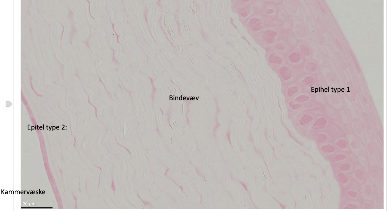 <p>Beskriv corneas epitheltype 1 og 2</p>