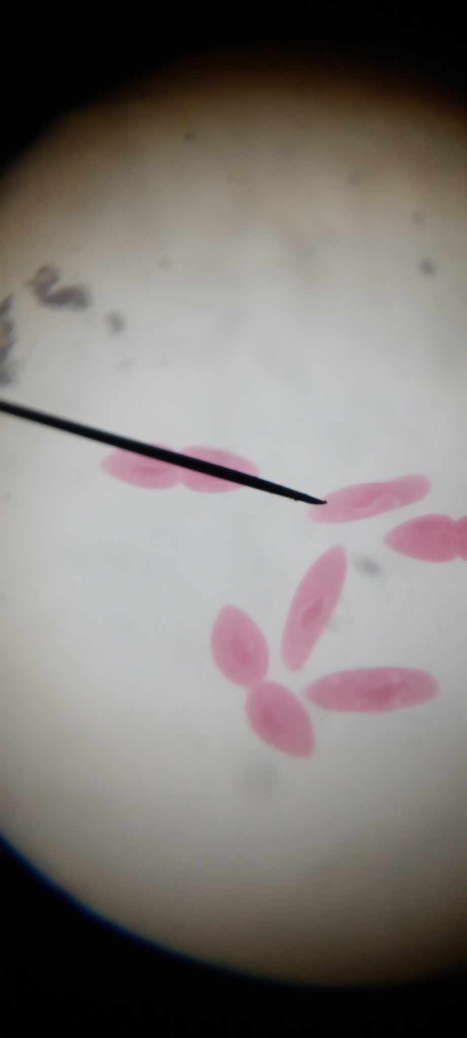 <p>macro-nuclei/micro-nuclei elongate;</p>