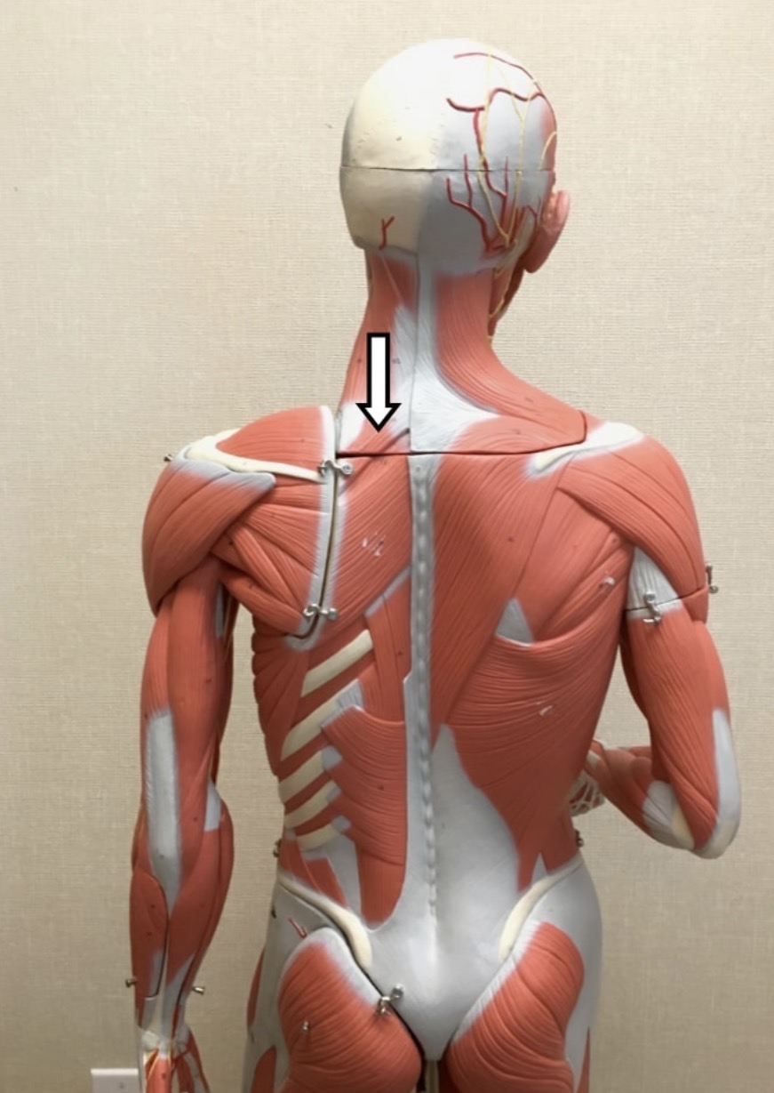 <p><span>Name the muscle labeled with the white arrow below AND name the origin</span></p>