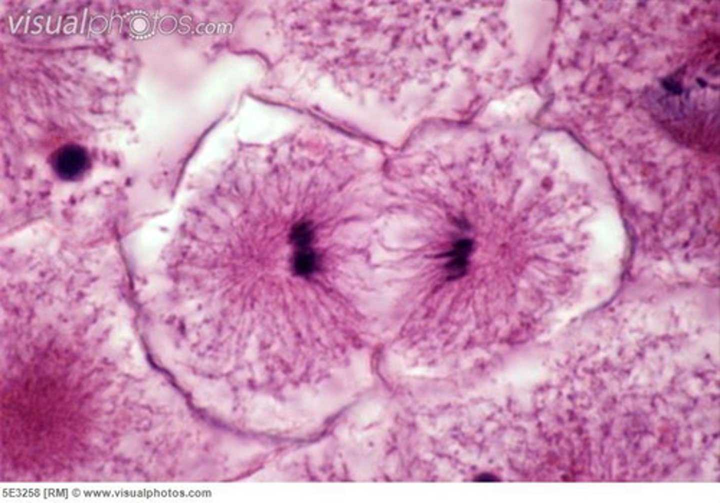 <p>nucei may start to be seen as they reform but are found in pairs that are smaller than they were in interphase. They may be round or irregular. Microtubles are seen in a dense bundle usually along the midbody of the cell. animal cells take on a cumbell shape as cytokinesis occur simultaneouly.</p>