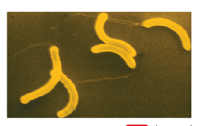 <p>Type of spiral bacteria</p>