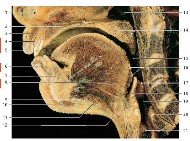 <p>Label the cadaver view of the Oral cavity (numbers 4, 5, 8, 14, 15, 16, 17)</p>