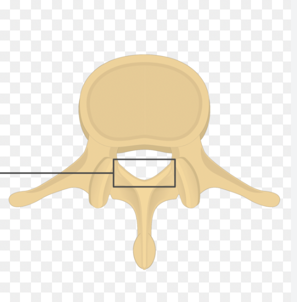 <p>Name this Vertebra?</p>