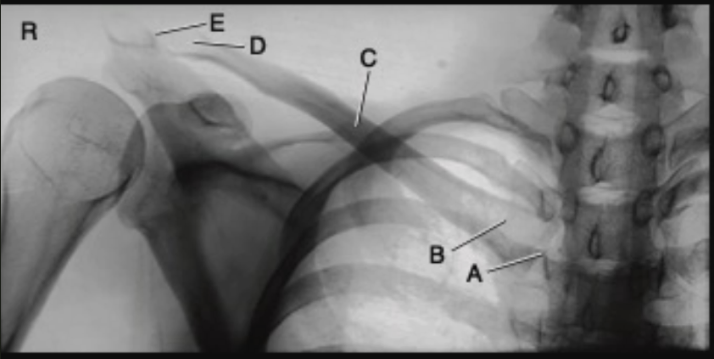 <p>A</p>