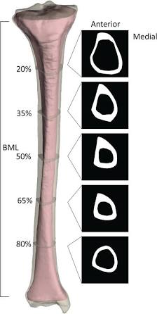 <p>triangular and large unlike femur</p>
