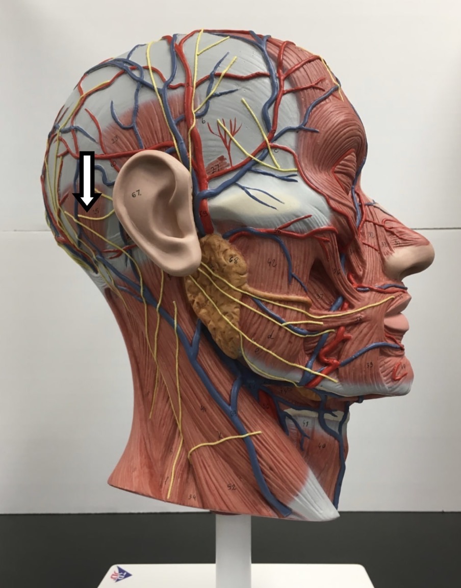 <p><span>Name the muscle labeled with the white arrow below:</span></p>