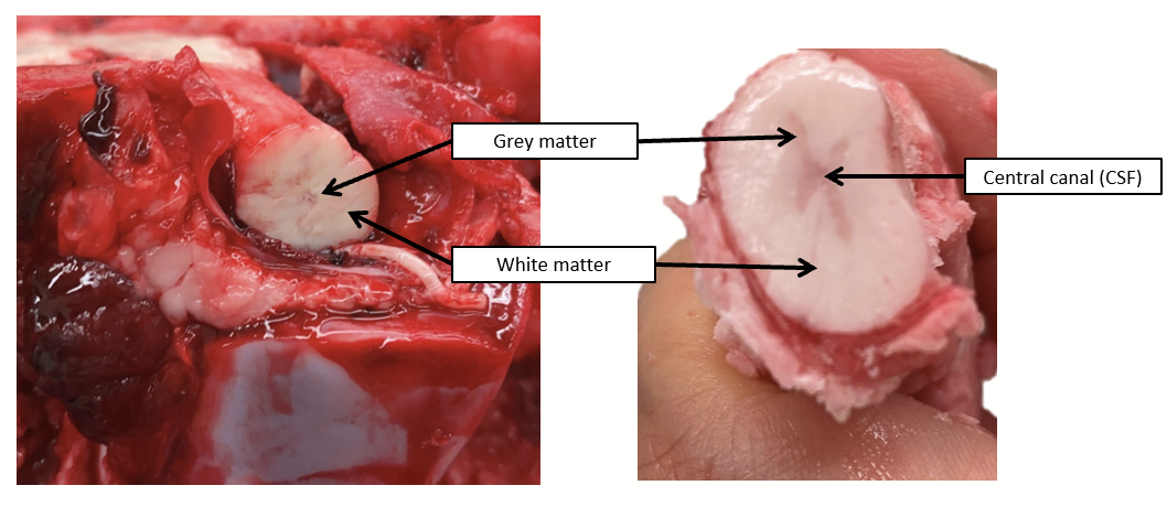 <p>Located at the center of the spinal cord, where cerebrospinal fluid is found.</p>