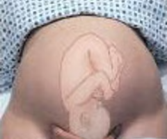 <p><span>determines what fetal part is lying above the pelvic inlet</span></p>