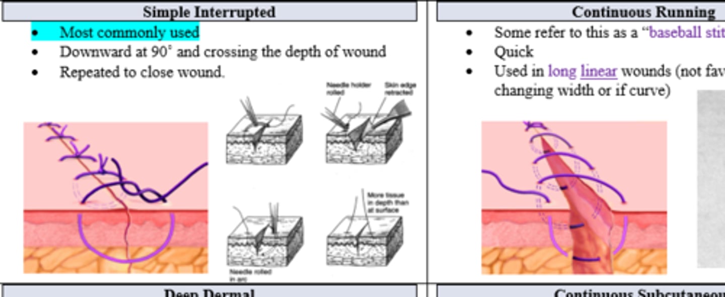 <p>Simple Interrupted Suture</p>