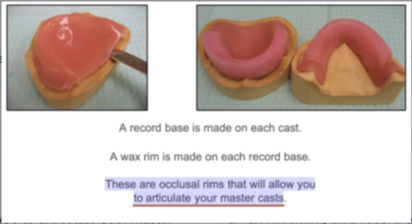 <p>a wax rim sitting on a record base that sits on the master cast</p>