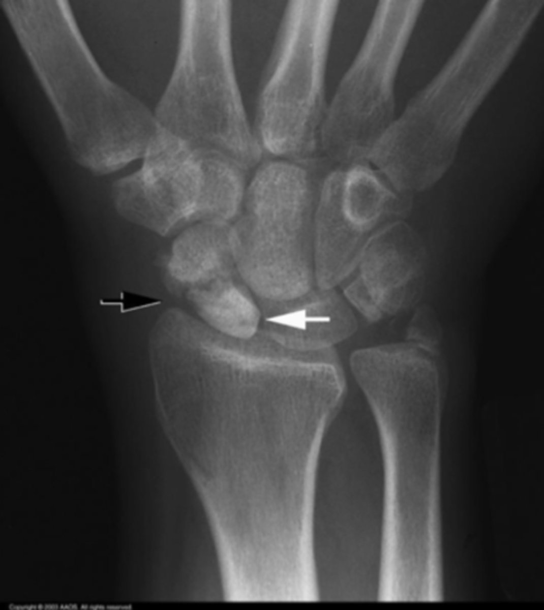 <p>What is the issue?</p>