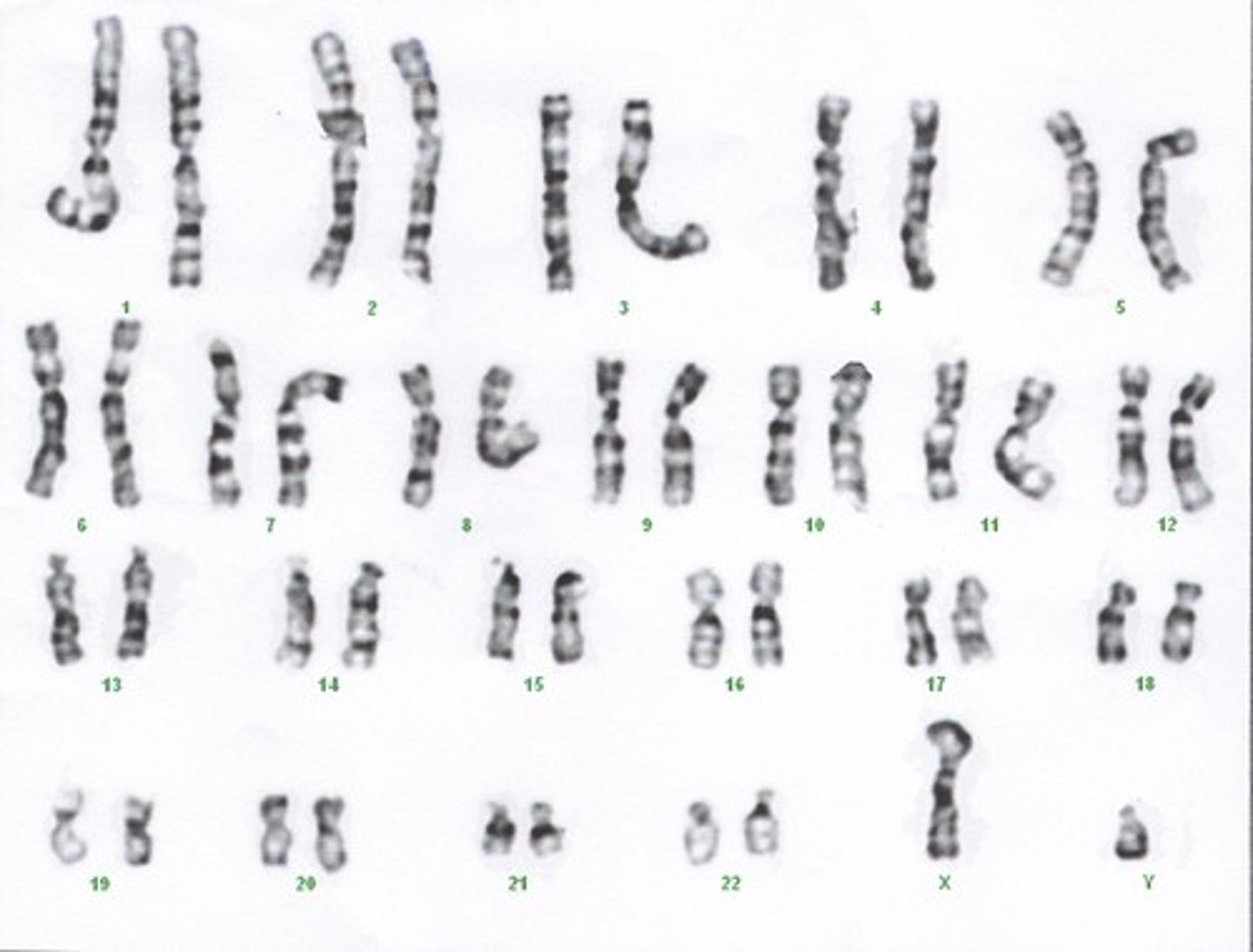 <p>shows the chromosomes of an organism in homologous pairs of decreasing length.</p>