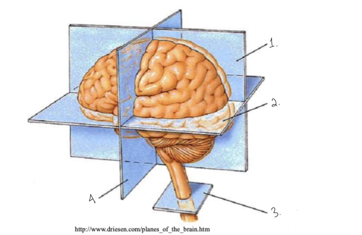 <p>label this diagram: terms for brain slices</p>