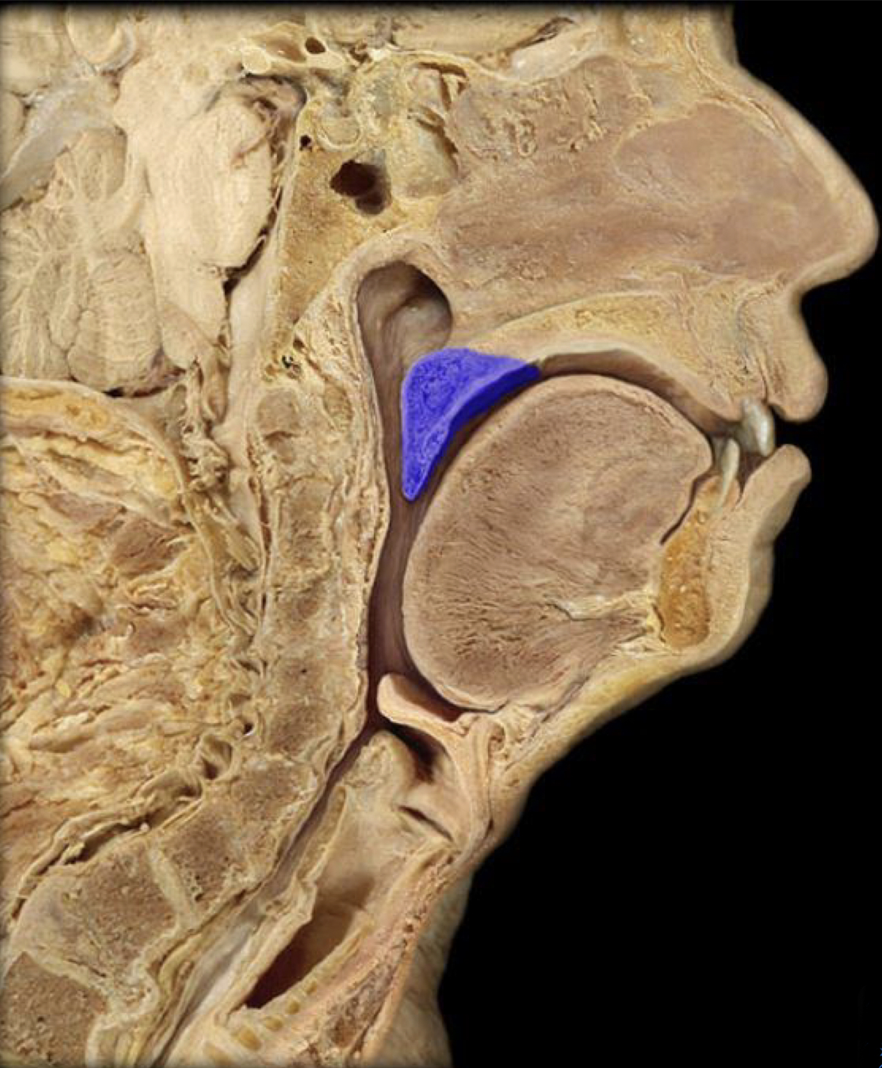 What structure is highlighted in blue?