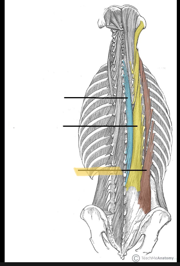 <p>Identify the highlighted muscle</p>