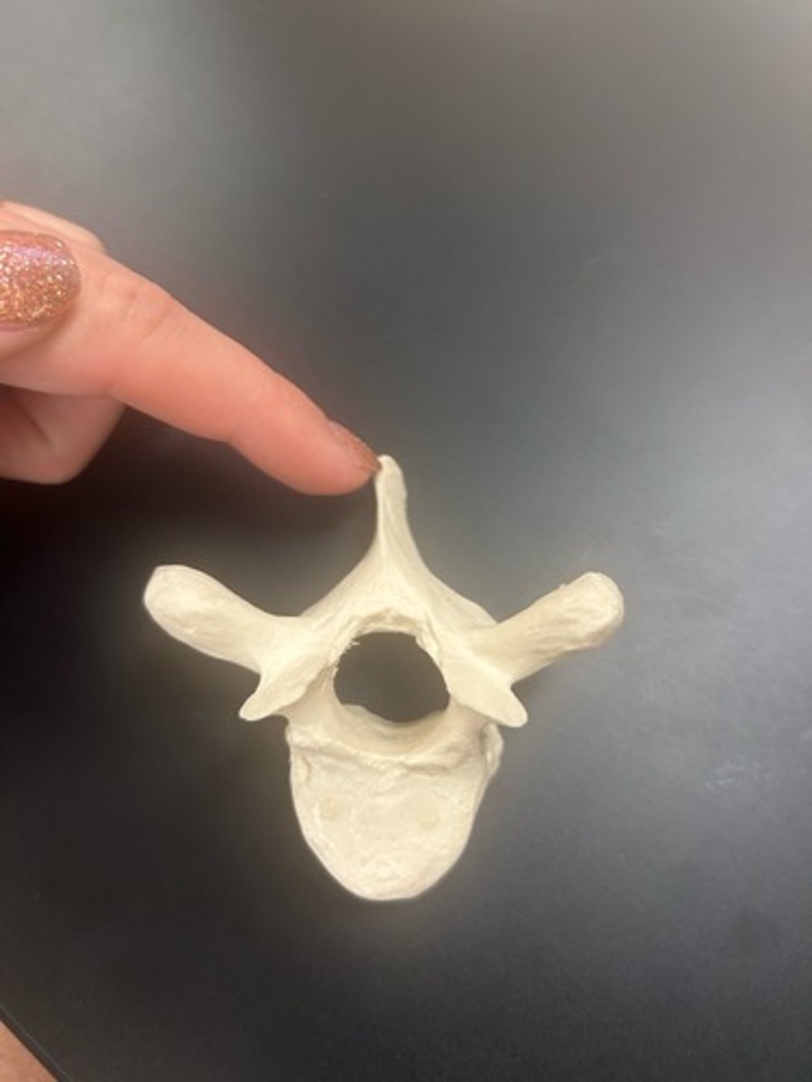 <p>name the bone</p>