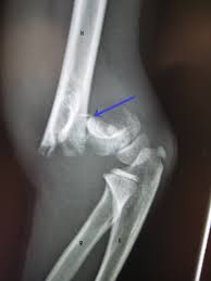 <p>What kind of pathology is shown in the image?</p>